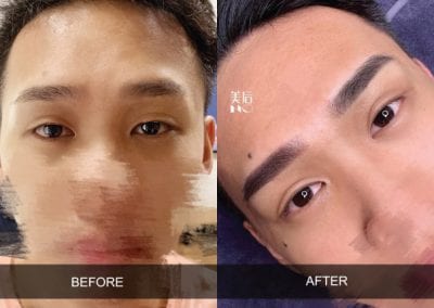 the macqueen before and after result of a men eyebrow embroidery result 2