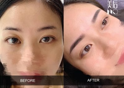 the macqueen before and after result eyebrow Microshading result