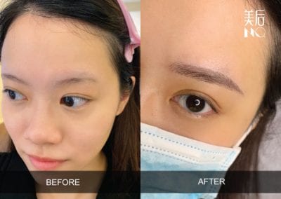 the macqueen before and after result microblading eyebrow embroidery result