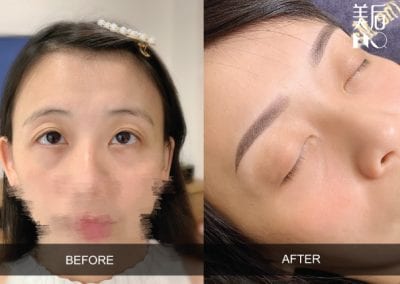 the macqueen before and after result eyebrow shape correction result