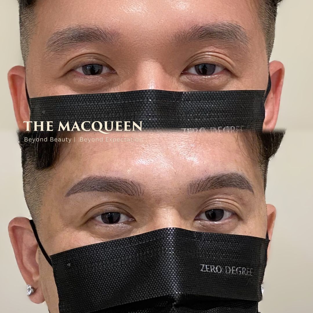Men Eyebrows Combination of Misty & Hairstroke embroidery Men eyebrows combo embroidery before after result by The MacQueen