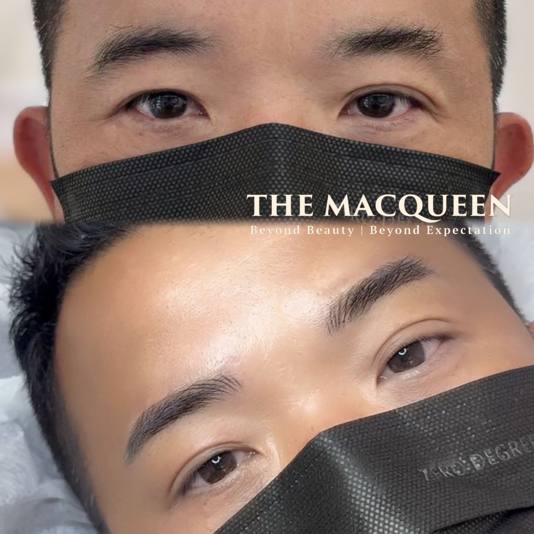 Men Microblading Eyebrows Embroidery Men eyebrow microblading eyebrow embroidery before after result by The MacQueen